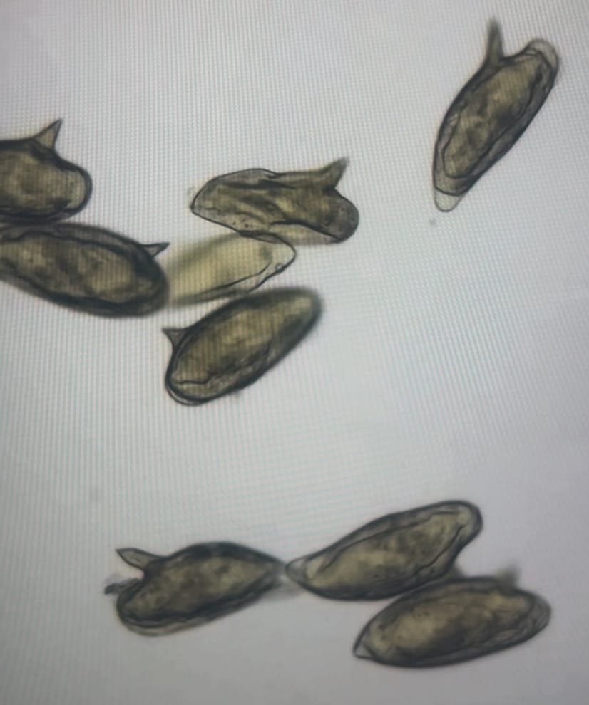Microscope view of a cluster of elongated, spined schistosome eggs